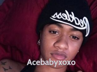 Acebabyxoxo