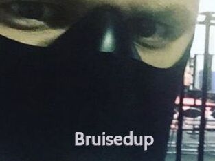 Bruisedup